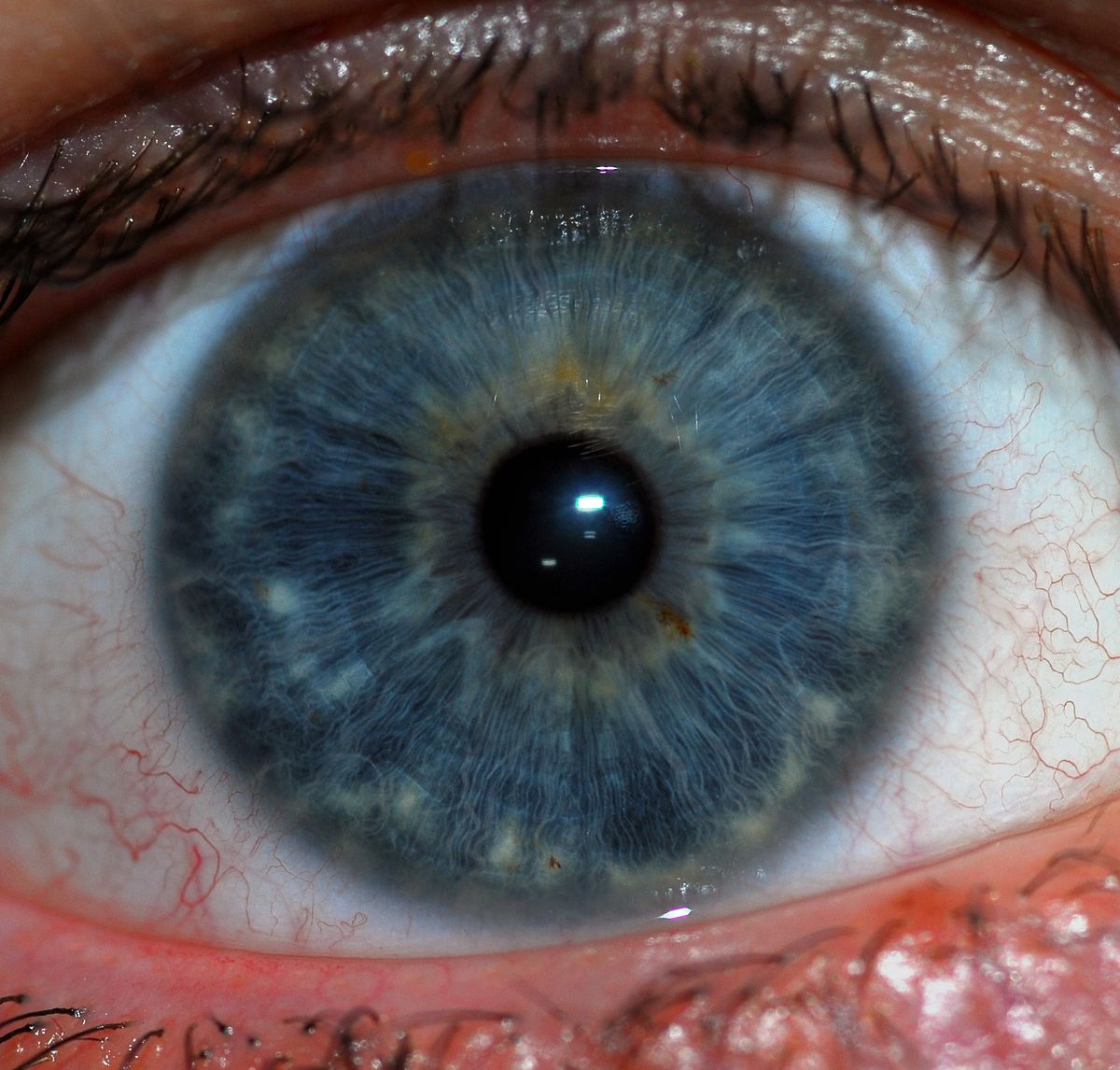 1200px-Human_Iris_JD052007.jpg